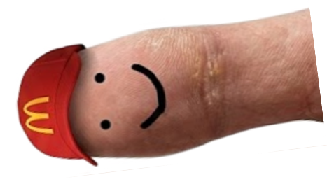 Toe with McDonald's cap